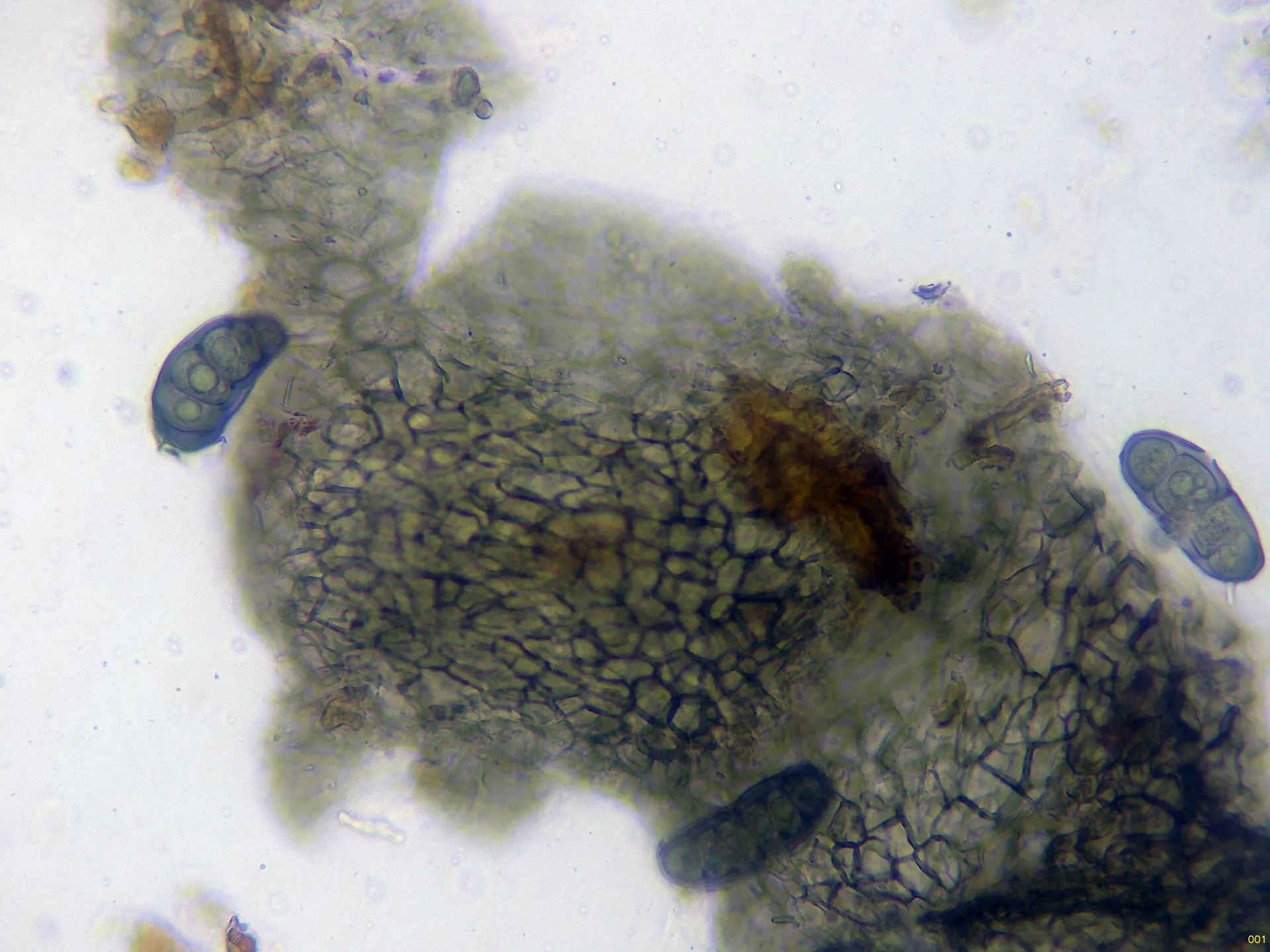 Microscopía de Splanchnonema platani - 12 - Peridio agua x 400-001